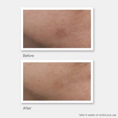 MURAD Rapid Age Spot Correcting Serum  Сыворотка для коррекции пигментных пятен Rapid