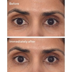 MURAD Retinol Youth Renewal Eye Masks  Ретиноловые омолаживающие маски для глаз