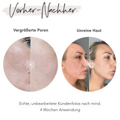 FACES OF FEY Microneedlingset Basic Niacinamid 0,25mm Набор для микронидлинга Basic Niacinamide 0,25 мм